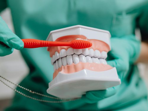 Tipps zur Zahnpflege bei Brücken: Besonders die angrenzenden Zähne pflegen. Und für die Kosten beim Zahnarzt kommt die Zahnzusatzversicherung CEZE auf.